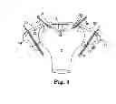 Fig. 04 - Methods and systems for treatment of prolapse