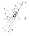 Fig. 03 - Kit for Placing Fixation Devices