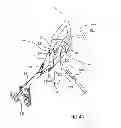 Fig. 05 - Kit for Placing Fixation Devices