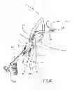 Fig. 06 - Kit for Placing Fixation Devices