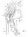 Fig. 09 - Kit for Placing Fixation Devices