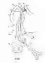 Fig. 10 - Kit for Placing Fixation Devices