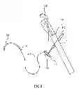 Fig. 11 - Kit for Placing Fixation Devices