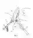 Fig. 12 - Kit for Placing Fixation Devices