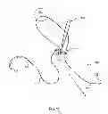 Fig. 13 - Kit for Placing Fixation Devices