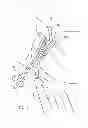 Fig. 14 - Kit for Placing Fixation Devices