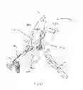 Fig. 15 - Kit for Placing Fixation Devices