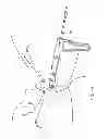 Fig. 16 - Kit for Placing Fixation Devices