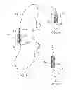 Fig. 19 - Kit for Placing Fixation Devices