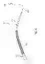 Fig. 20 - Kit for Placing Fixation Devices