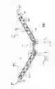 Fig. 29 - Kit for Placing Fixation Devices