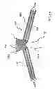 Fig. 30 - Kit for Placing Fixation Devices