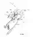 Fig. 32 - Kit for Placing Fixation Devices
