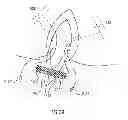 Fig. 35 - Kit for Placing Fixation Devices
