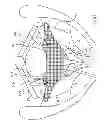 Fig. 43 - Kit for Placing Fixation Devices