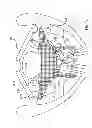 Fig. 45 - Kit for Placing Fixation Devices