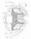 Fig. 47 - Kit for Placing Fixation Devices
