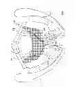 Fig. 48 - Kit for Placing Fixation Devices