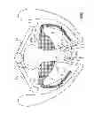 Fig. 49 - Kit for Placing Fixation Devices