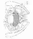 Fig. 50 - Kit for Placing Fixation Devices