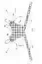 Fig. 52 - Kit for Placing Fixation Devices