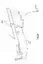Fig. 55 - Kit for Placing Fixation Devices