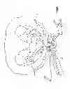 Fig. 56 - Kit for Placing Fixation Devices