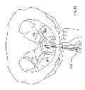 Fig. 57 - Kit for Placing Fixation Devices