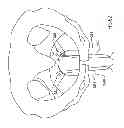 Fig. 58 - Kit for Placing Fixation Devices