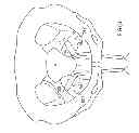 Fig. 59 - Kit for Placing Fixation Devices