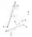 Fig. 62 - Kit for Placing Fixation Devices