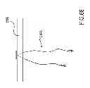 Fig. 64 - Kit for Placing Fixation Devices