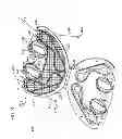 Fig. 70 - Kit for Placing Fixation Devices