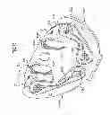 Fig. 71 - Kit for Placing Fixation Devices