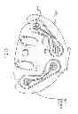 Fig. 72 - Kit for Placing Fixation Devices