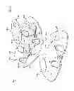 Fig. 76 - Kit for Placing Fixation Devices