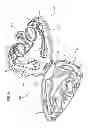 Fig. 80 - Kit for Placing Fixation Devices