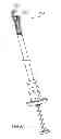 Fig. 84 - Kit for Placing Fixation Devices