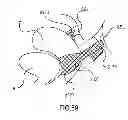 Fig. 85 - Kit for Placing Fixation Devices