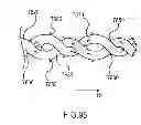 Fig. 91 - Kit for Placing Fixation Devices