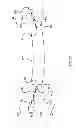 Fig. 94 - Kit for Placing Fixation Devices