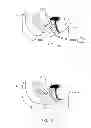 Fig. 97 - Kit for Placing Fixation Devices