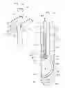 Fig. 06 - Apparatus For Treating Vaginal Prolapse