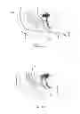 Fig. 11 - Apparatus For Treating Vaginal Prolapse
