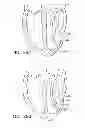 Fig. 33 - Systems and methods for improving cardiac function