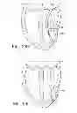 Fig. 34 - Systems and methods for improving cardiac function