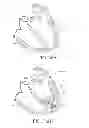 Fig. 43 - Systems and methods for improving cardiac function