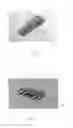 Fig. 04 - Video retractor