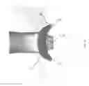 Fig. 10 - Video retractor