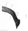 Fig. 12 - Video retractor